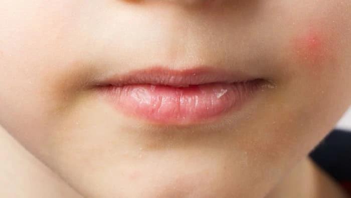 بالم لب برای کودکان: راهنمای ایمنی و انتخاب محصول مناسب